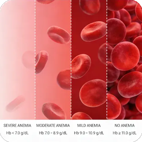 شرح تحاليل الأنيميا والفيتامينات