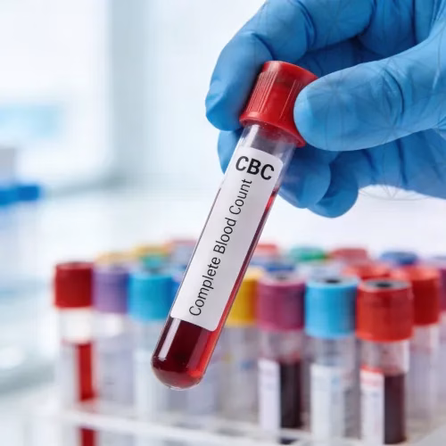 فحص صورة الدم الكاملة CBC في الجيزة | تشخيص الأنيميا والالتهابات – معمل مصر