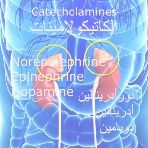 تحليل الكاتيكولامينات في البول - تشخيص ورم القواتم