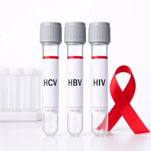 فحص HCV HBV VIH بالـ PCR STD. كشف مباشر للمادة الوراثية للفيروسات الثلاثة. نتائج سريعة ودقيقة. أعلى حساسية في الكشف المبكر.