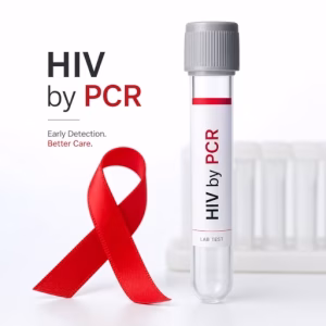 اختبار HIV المتقدم بالـ PCR STD. الكشف الجزيئي المباشر للفيروس بعد 10-14 يوماً فقط. أسرع وأدق من الجيل الرابع. نتائج خلال 48 ساعة.