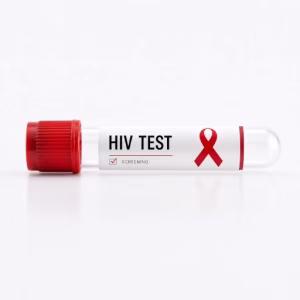 اختبار VIH الأساسي مع p24 بالجيل الرابع STD. يجمع بين الأجسام المضادة لـ VIH-1 وVIH-2 ومستضد p24. فترة النافذة 28 يوماً. نتائج دقيقة وسريعة.
